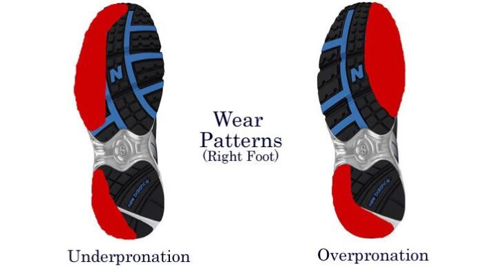 best shoes for underpronation